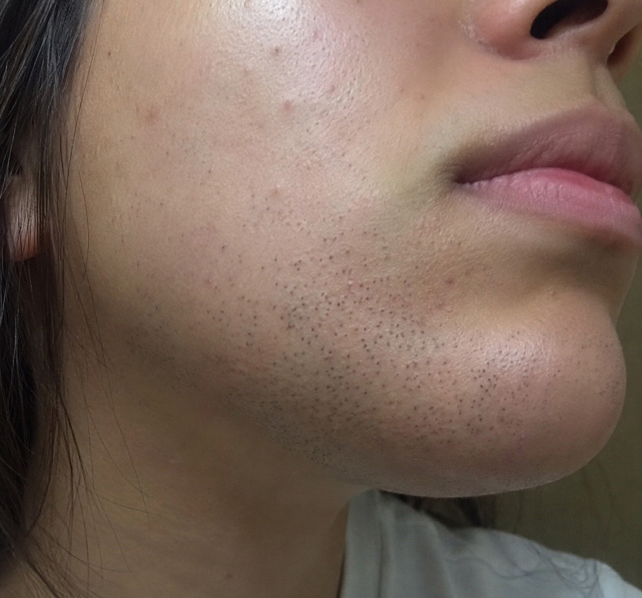 Before