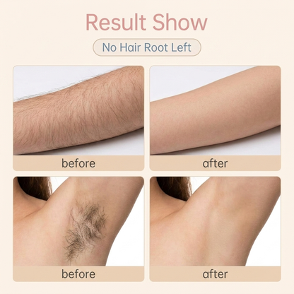 900,000 Flashes Laser IPL Hair Removal Device
